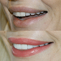 Dental Treaments