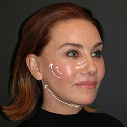 Face Aesthetics
